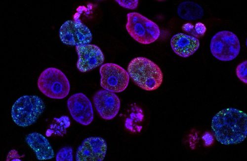 瑞士生物科技公司invasight利用突破性的細(xì)胞間蛋白靶點(diǎn)發(fā)現(xiàn)平臺(tái),開(kāi)發(fā)蛋白質(zhì) 蛋白質(zhì)相互作用抑制劑,靶向治療侵襲性癌癥 瑞士創(chuàng)新100強(qiáng)